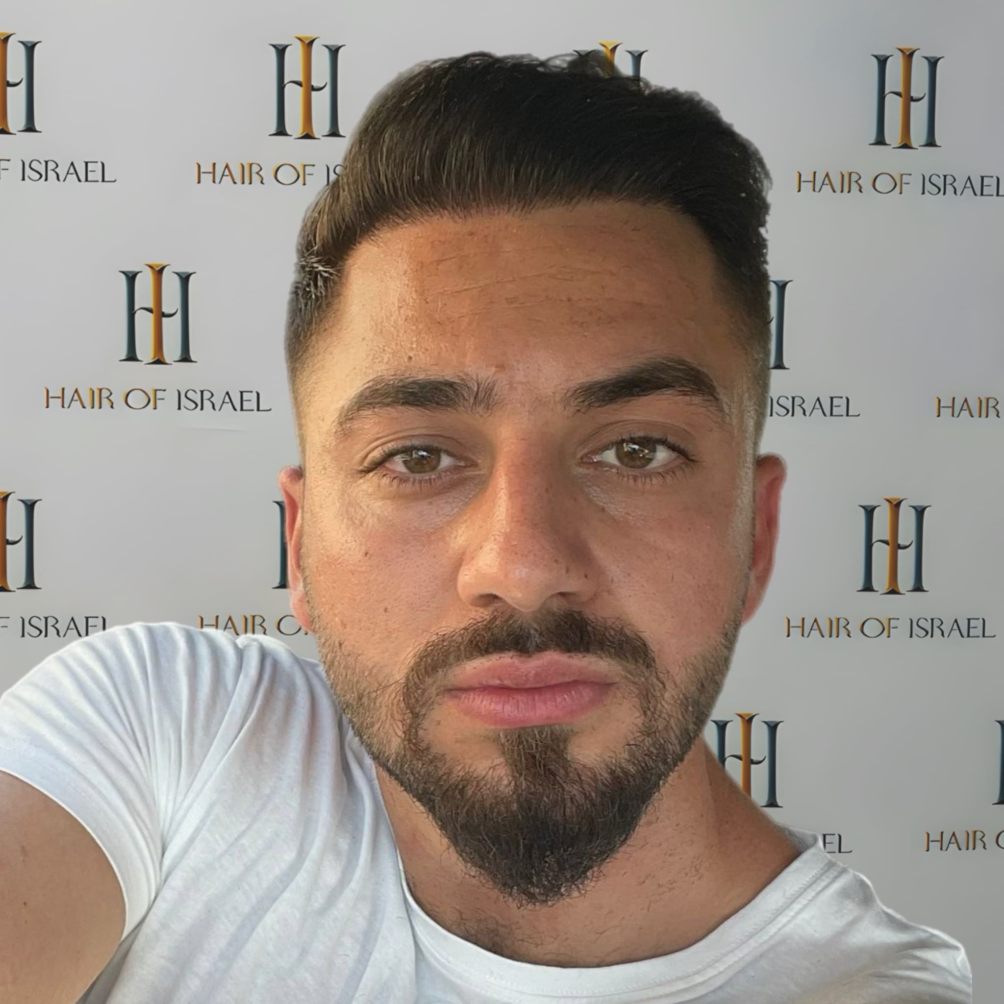 אחרי השתלה — מטופל 1