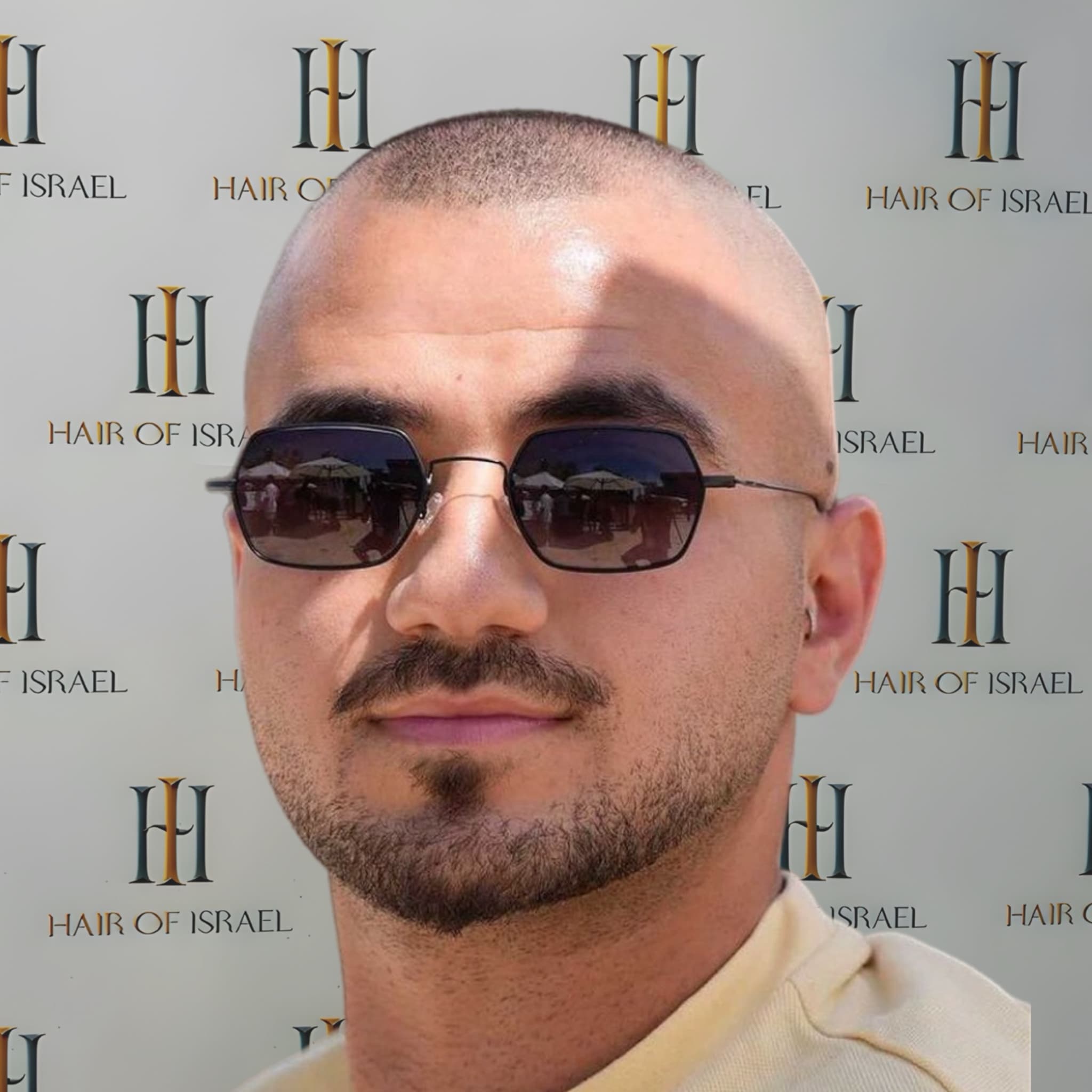 לפני השתלה — מטופל 3