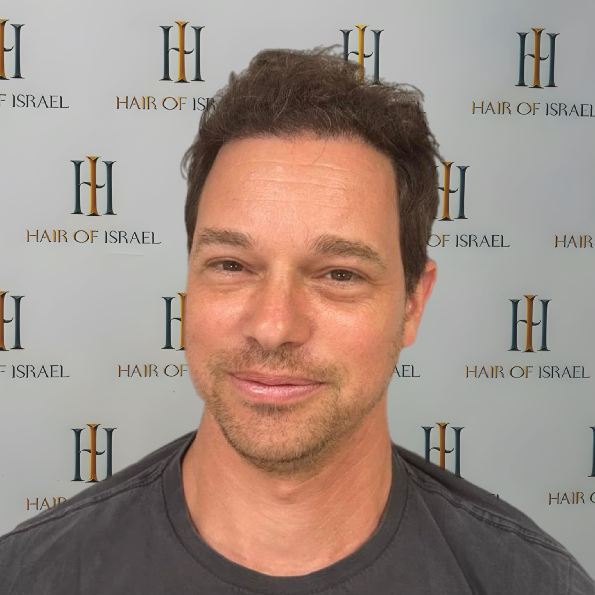 אחרי השתלה — מטופל 4