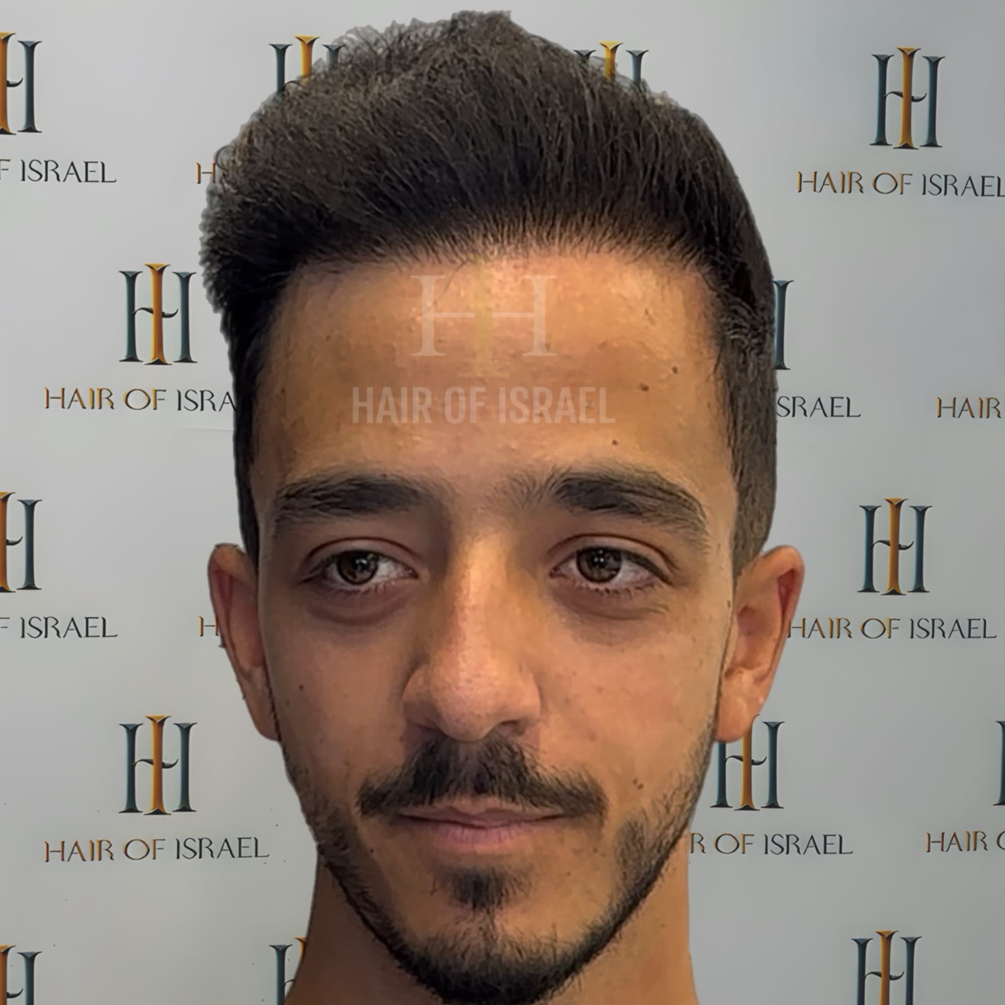 אחרי השתלה — מטופל 6