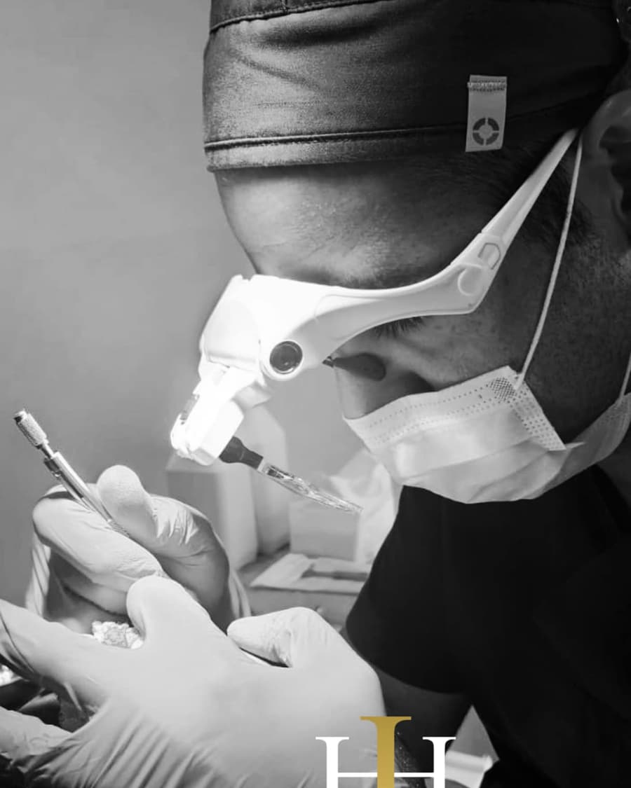 רופא Hair of Israel מבצע השתלת שיער בהגדלה מיקרו-כירורגית