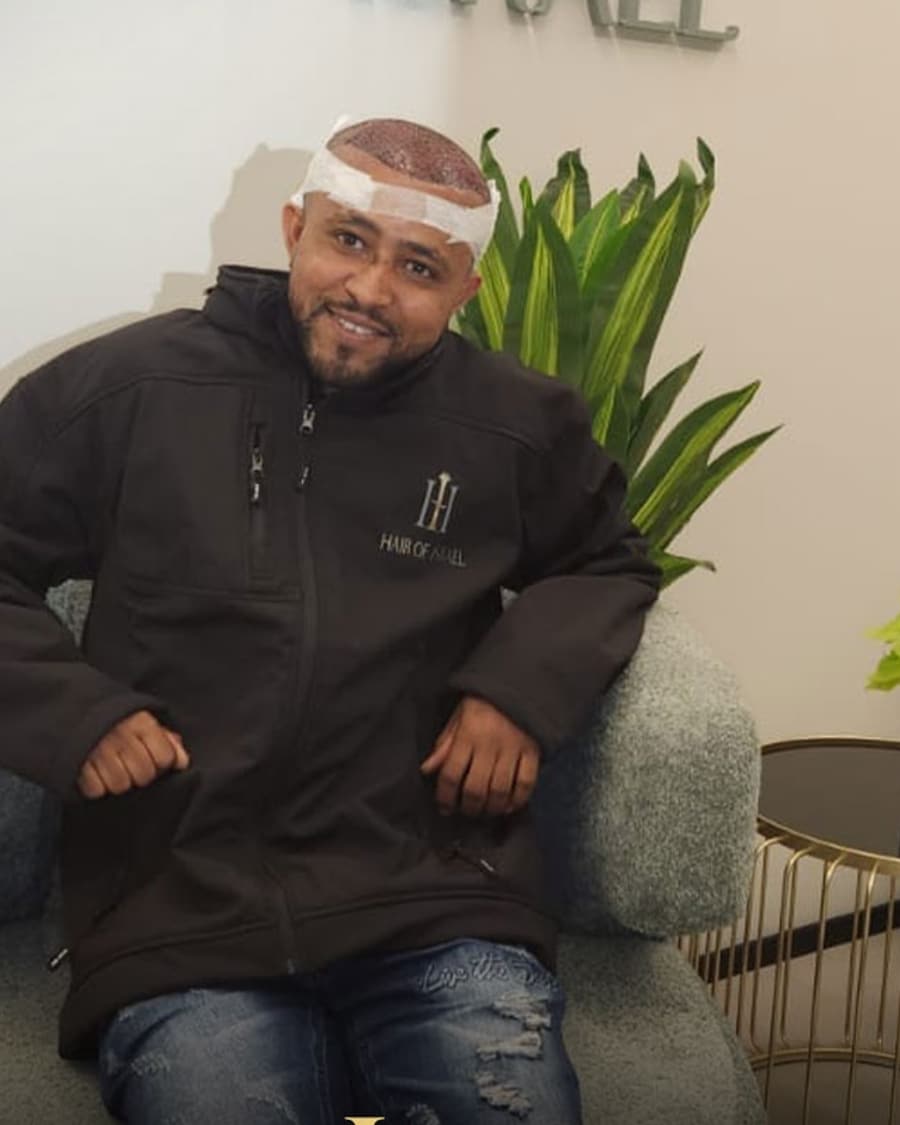 מטופל בקליניקה אחרי השתלת שיער